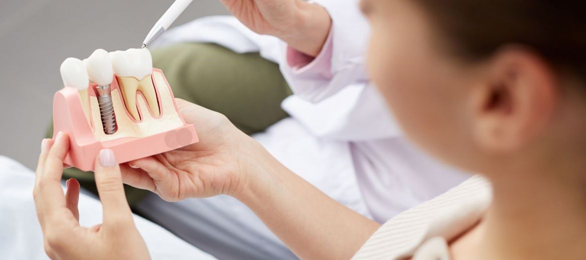Dental Implants